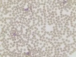 Acid phosphatase leukocyte (trap) kit 1 kit