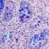 Alcian Blue for PAS Staining Kit ref 05279194001 tranche 1