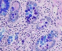Alcian Blue for PAS Staining Kit ref 05279194001 tranche 1