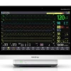 BeneVision N15 N15 sdt