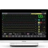BeneVision N17 N17 sdt