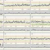 Centrale de surveillance obstétricale Mosos, 64 lits