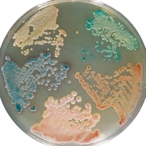 Chromagar candida sp. - 2x10