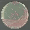 Chromagar mrsa - 2x10