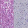 Diastase Kit ref 05279208001 tranche 1
