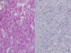 Diastase Kit ref 05279208001 tranche 1