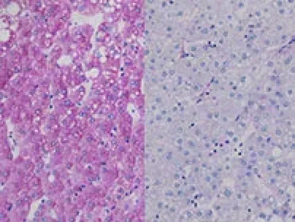 Diastase Kit ref 05279208001 tranche 1