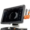 Echographe d'ophtalmologie Absolu - connexion avec sondes B 15MHz, Lin 50MHz et Biométrie - Console (sans sondes)