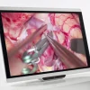 Ecran 2D Full HD à UHD, moniteur 27'' médicalisé ACL LED,