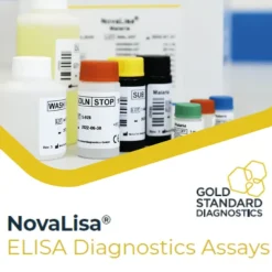 Entamoeba histolytica IgG (Amebiasis) 96 tests