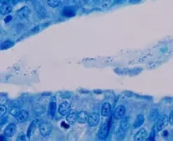 Giemsa Staining Kit ref 05279224001 tranche 4