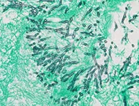 GMS II Staining Kit ref 05412749001 tranche 4