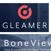 IA GLEAMER pour FDR NANO