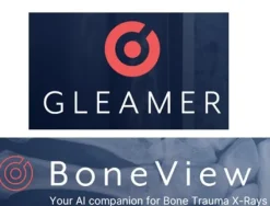 IA GLEAMER pour FDR NANO