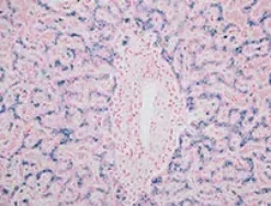 Iron Staining Kit ref 05279259001 tranche 5
