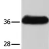 Kit de Dosage Activité Collagenase (Colorimétrique) 100 Tests
