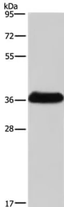 Kit de Dosage Activité Collagenase (Colorimétrique) 100 Tests