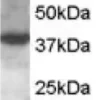 Kit de Dosage D-Lactate 100 Tests