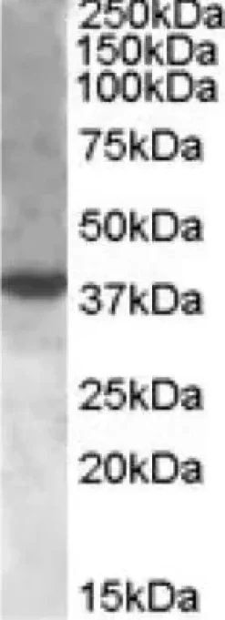 Kit de Dosage D-Lactate 100 Tests