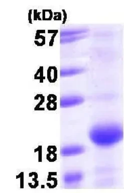 Kit de Dosage Glutamate 100 Tests