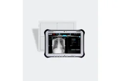 Kit de numérisation Artpix Mobile EZ2GO (2430) Capteur wifi MAX mini (Pixium Portable 2430 EZ-C),tablette