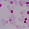 Kit Hémoglobine Foetale, 100 tests x 1