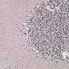 Kit PTAH (Acide phosphotungstique et hematoxyline), 100 tests x1