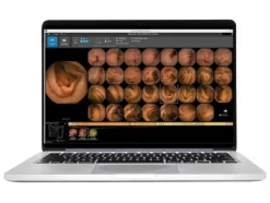 Logiciel d'analyse Pillcam V9