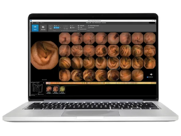 Logiciel d'analyse Pillcam V9