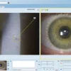 Logiciel EYESUITE pour IM 910