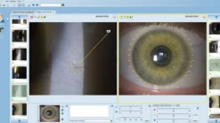 Logiciel EYESUITE pour IM 910