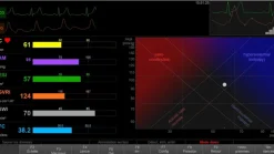 Moniteur NICCOMO-CardioScreen 1000 Pro - Ecran PC Médical Tactile