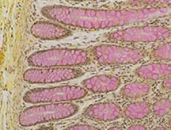 Mucicarmine Staining Kit ref 05279275001 tranche 3