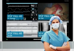 Négatoscope numérique OPERION - 4K proposé - taille écran 64,5''