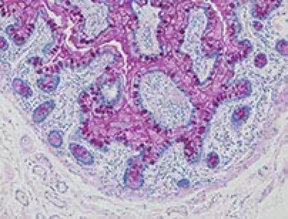 PAS Staining Kit ref 05279291001 tranche 5