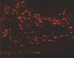 Pkh26 red fluorescent cell linker midi k 1 kit