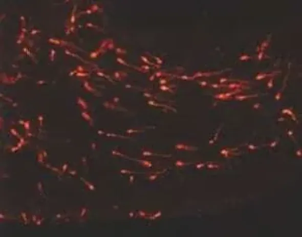 Pkh26 red fluorescent cell linker midi k 1 kit