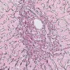 Reticulum II Staining Kit ref 05279399001 tranche 3