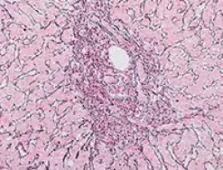 Reticulum II Staining Kit ref 05279399001 tranche 3