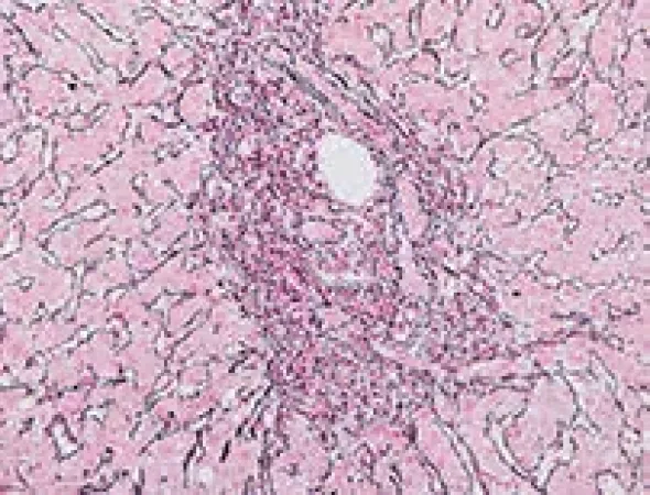 Reticulum II Staining Kit ref 05279399001 tranche 3