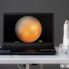 Rétinographe grand champ de néonatologie portable BabyCam idéal pour l enfant prématuré Valise de transport incluse