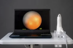 Rétinographe grand champ de néonatologie portable BabyCam idéal pour l enfant prématuré Valise de transport incluse
