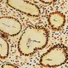 Steiner II Staining Kit ref 06521894001 tranche 1