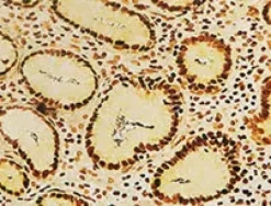 Steiner II Staining Kit ref 06521894001 tranche 1