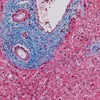 Trichrome Staining Kit ref 06521908001 tranche 2