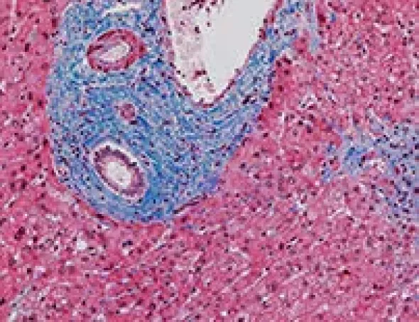 Trichrome Staining Kit ref 06521908001 tranche 2
