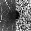 Upgrade Module OCT-Angiographie
