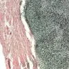 Von kossa 100 tests