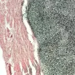 Von kossa 100 tests