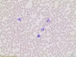 Wright-giemsa stain modified (manual) 500 ml